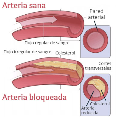 arterias
